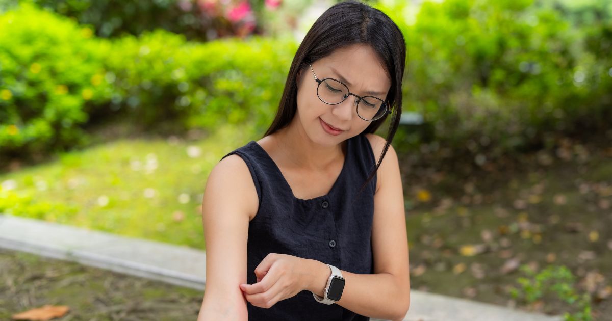 10 Bug Bites & Stings You Should Not Ignore