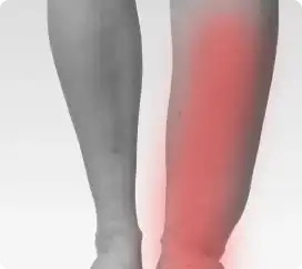 Swelling, bruising, or deformity