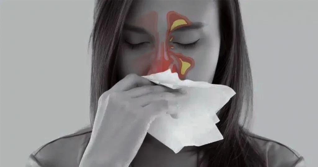 Woman with tissue, highlighted areas showing sinus headache