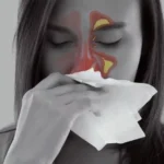 Woman with tissue, highlighted areas showing sinus headache