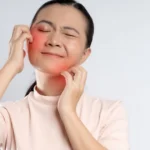 Woman scratching reddened, itchy cheeks with visible discomfort.