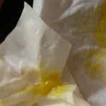 Yellow mucus on tissue showing possible respiratory infection.