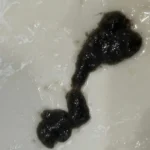 Black sticky mucus cluster on surface.