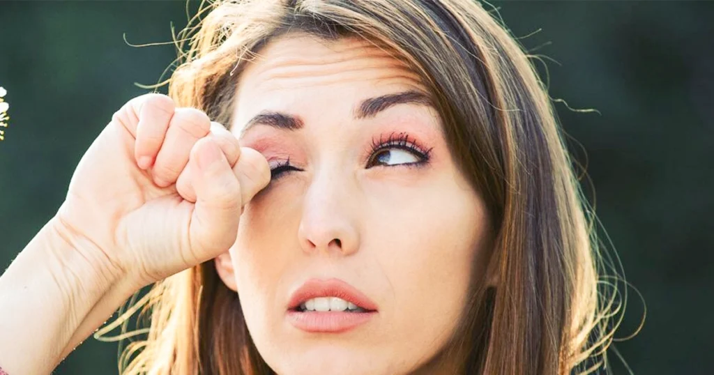 Woman rubbing itchy irritated eye from allergy.