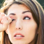 Woman rubbing itchy irritated eye from allergy.