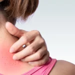 Dehydration causes headaches during outdoor heat exposure.