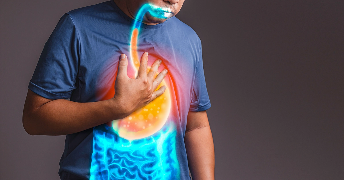 Can Gerd Cause Nausea