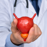 Icons explaining enlarged prostate risk factors.