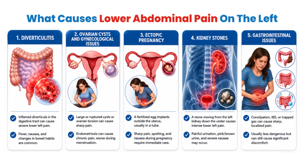 Infographic showing common causes of lower left abdominal pain.