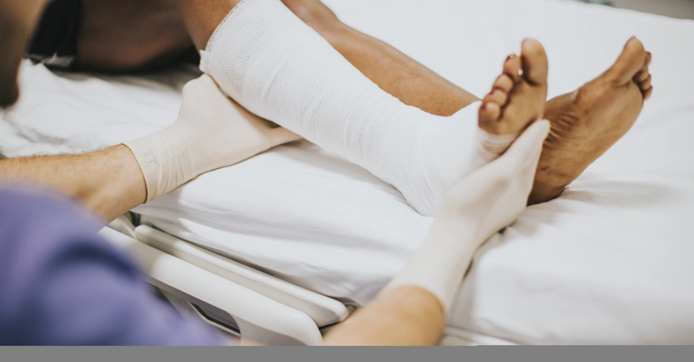 Bone Fractures (Broken Bones)