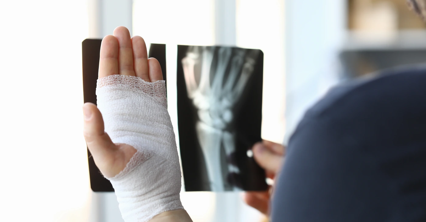 Soft Tissue Injury: Symptoms, Treatment, Causes & Recovery Process