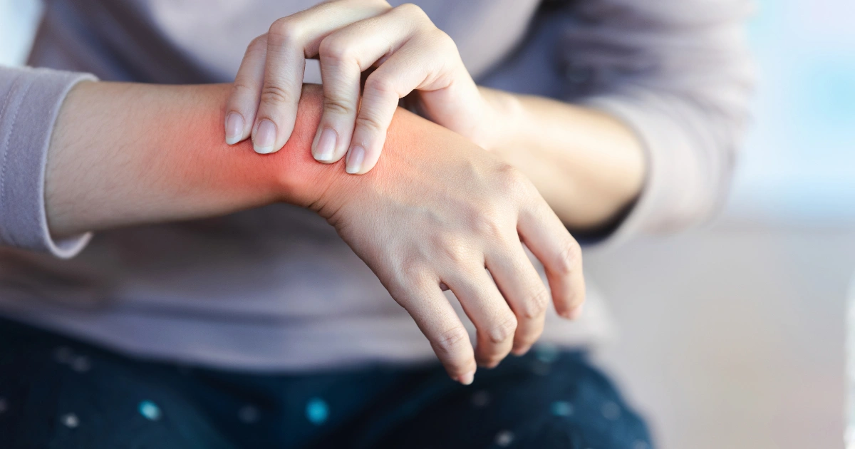 What Is A Pinched Nerve?
