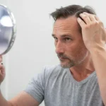 Middle-aged man examining his receding hairline in a mirror.