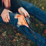 Person sitting outside with bloody wound through torn blue jeans.